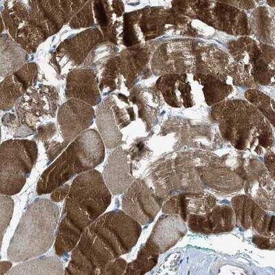 Immunohistochemistry-Paraffin: CDO Antibody [NBP1-85700]