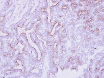 Immunohistochemistry-Paraffin: CDO Antibody [NBP2-15849]
