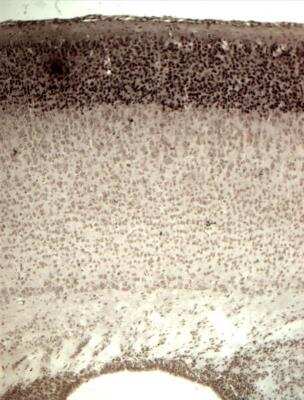 Immunohistochemistry-Paraffin: CDP/CUTL1 Antibody (2A10) [H00001523-M01]