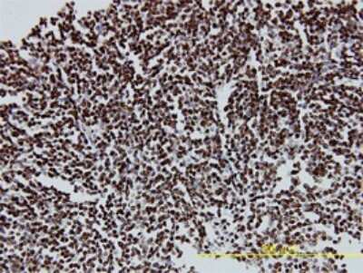 Immunohistochemistry-Paraffin: CDP/CUTL1 Antibody (2A10) [H00001523-M01]