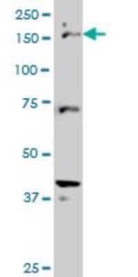 Western Blot: CDP/CUTL1 Antibody (2D10) [H00001523-M02]