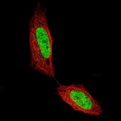 Immunocytochemistry/ Immunofluorescence: CDP/CUTL1 Antibody (CL5275) [NBP2-61408]