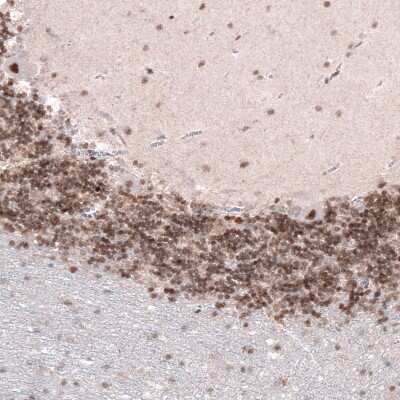 Immunohistochemistry-Paraffin: CDP/CUTL1 Antibody (CL5275) [NBP2-61408]