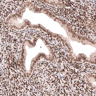 Immunohistochemistry-Paraffin: CDP/CUTL1 Antibody (CL5275) [NBP2-61408]