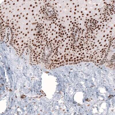 Immunohistochemistry-Paraffin: CDP/CUTL1 Antibody (CL5275) [NBP2-61408]