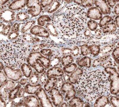 Immunohistochemistry-Paraffin: CDP/CUTL1 Antibody (CL5275) [NBP2-61408]
