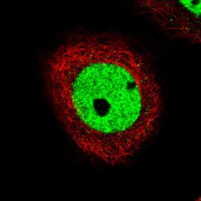 Immunocytochemistry/ Immunofluorescence: CDP/CUTL1 Antibody (CL5278) [NBP2-61409]