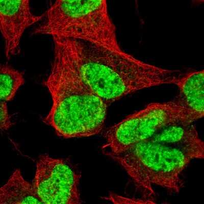 Immunocytochemistry/ Immunofluorescence: CDP/CUTL1 Antibody (CL5278) [NBP2-61409]