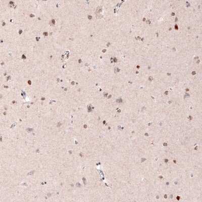 Immunohistochemistry-Paraffin: CDP/CUTL1 Antibody (CL5278) [NBP2-61409]