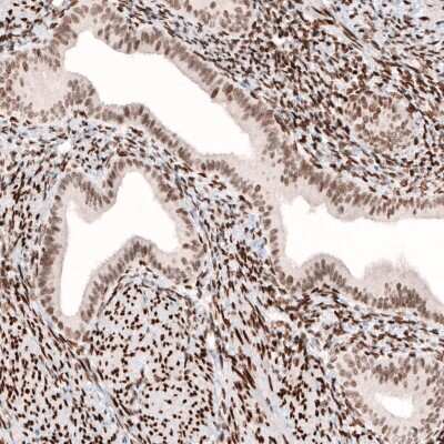 Immunohistochemistry-Paraffin: CDP/CUTL1 Antibody (CL5278) [NBP2-61409]