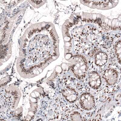 Immunohistochemistry-Paraffin: CDP/CUTL1 Antibody (CL5278) [NBP2-61409]