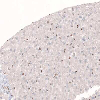 Immunohistochemistry-Paraffin: CDP/CUTL1 Antibody (CL5278) [NBP2-61409]