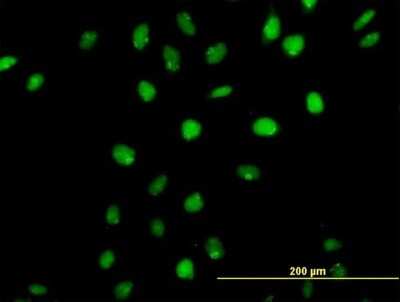 Immunocytochemistry/ Immunofluorescence: CDP/CUTL1 Antibody [H00001523-B01P]