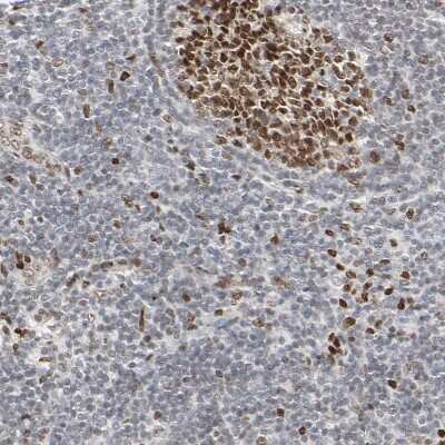 Immunohistochemistry-Paraffin: CDP/CUTL1 Antibody [NBP1-88187]