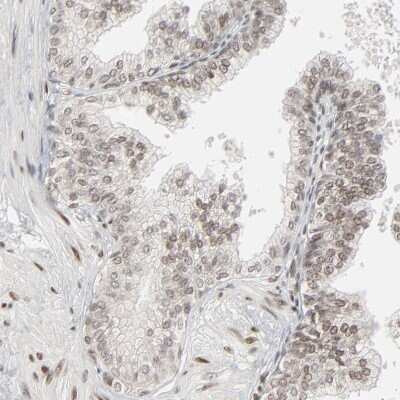 Immunohistochemistry-Paraffin: CDP/CUTL1 Antibody [NBP1-88187]