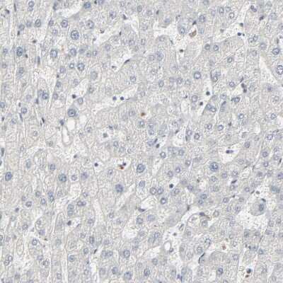 Immunohistochemistry-Paraffin: CDP/CUTL1 Antibody [NBP1-88187]