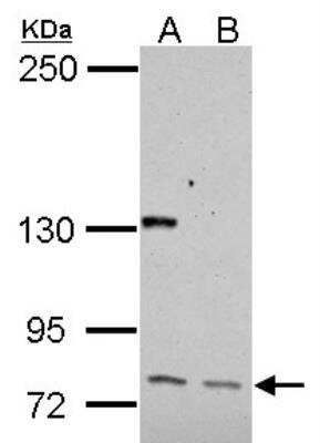 Western Blot: CDP/CUTL1 Antibody [NBP2-16039]