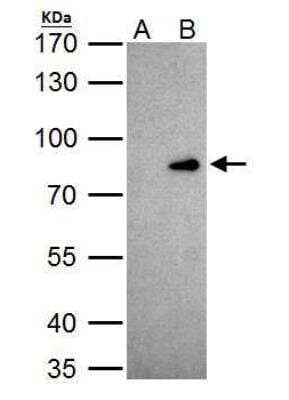 Western Blot: CDP/CUTL1 Antibody [NBP2-16039]