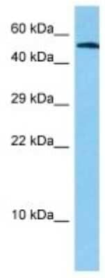 Western Blot: CDP/CUTL1 Antibody [NBP3-10866]