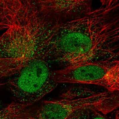 Immunocytochemistry/ Immunofluorescence: CDR1 Antibody [NBP2-57758]