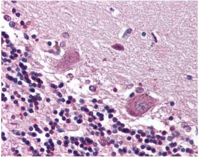Immunohistochemistry: CDR2 Antibody [NB110-58345]