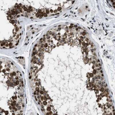 Immunohistochemistry-Paraffin: CDR2 Antibody [NBP1-84562]
