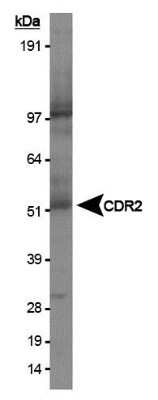 Western Blot: CDR2 Antibody [NB110-58345]