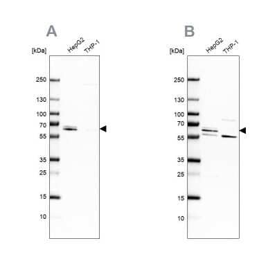 Western Blot: CDR2 Antibody [NBP1-84561]