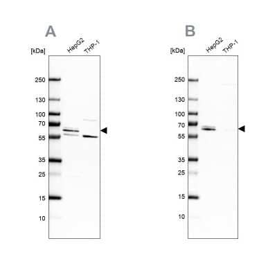 Western Blot: CDR2 Antibody [NBP1-84562]