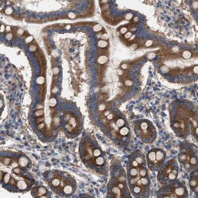 Immunohistochemistry-Paraffin: CDR2L Antibody [NBP1-93681]