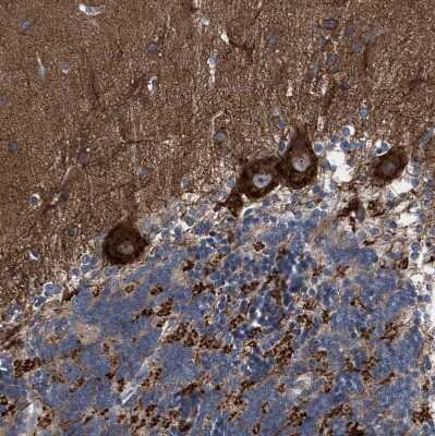 Immunohistochemistry-Paraffin: CDR2L Antibody [NBP1-93681]