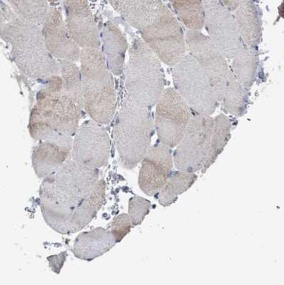 Immunohistochemistry-Paraffin: CDR2L Antibody [NBP1-93681]