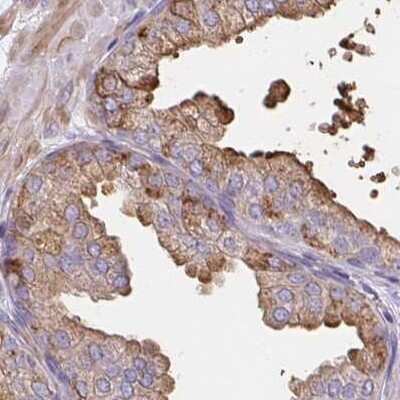 Immunohistochemistry-Paraffin: CDRT15 Antibody [NBP2-34174]