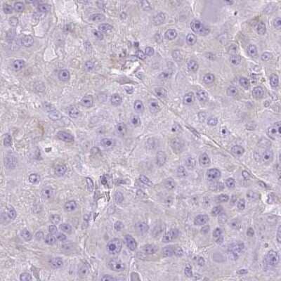 Immunohistochemistry-Paraffin: CDRT15 Antibody [NBP2-34174]