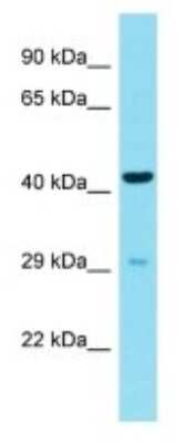 Western Blot: CDRT15L2 Antibody [NBP3-09663]