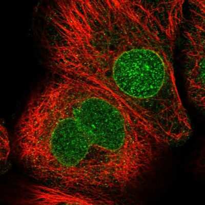 Immunocytochemistry/ Immunofluorescence: CDS1 Antibody [NBP1-85894]