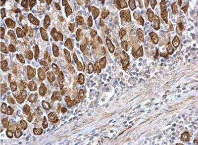 Immunohistochemistry-Paraffin: CDS1 Antibody [NBP1-33434]