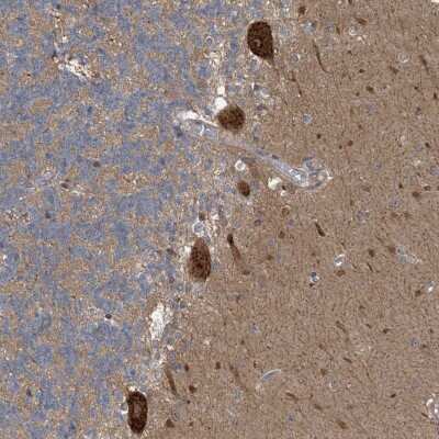Immunohistochemistry-Paraffin: CDS1 Antibody [NBP1-85894]
