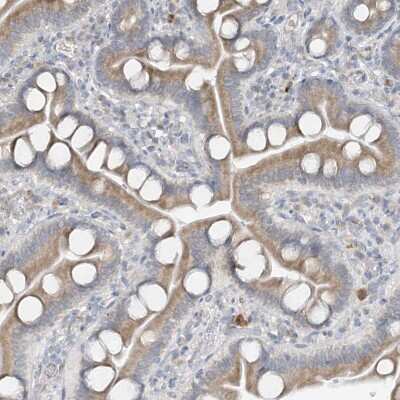 Immunohistochemistry-Paraffin: CDS1 Antibody [NBP1-85894]