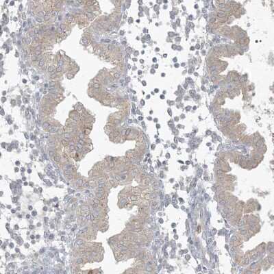 Immunohistochemistry-Paraffin: CDS1 Antibody [NBP1-85894]