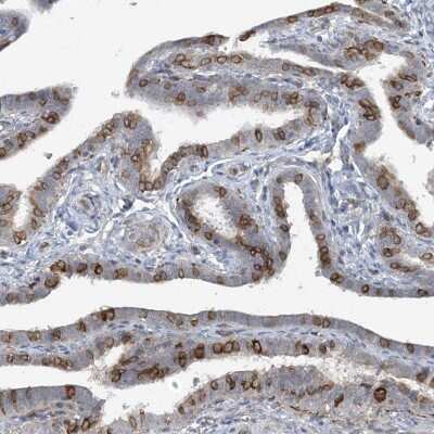 Immunohistochemistry-Paraffin: CDS1 Antibody [NBP1-85894]