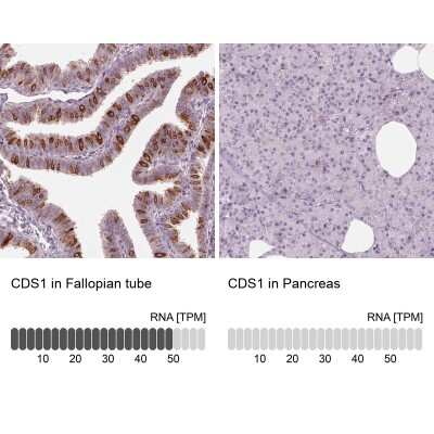Immunohistochemistry-Paraffin: CDS1 Antibody [NBP2-62643]