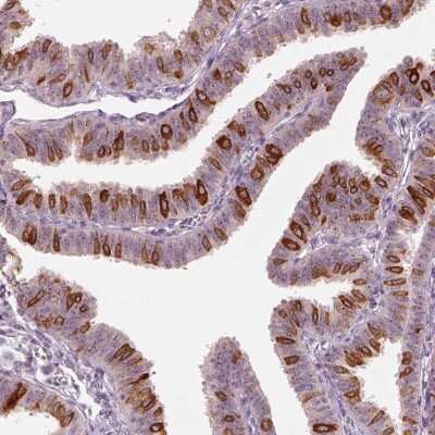 Immunohistochemistry-Paraffin: CDS1 Antibody [NBP2-62643]