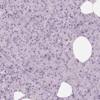 Immunohistochemistry-Paraffin: CDS1 Antibody [NBP2-62643]