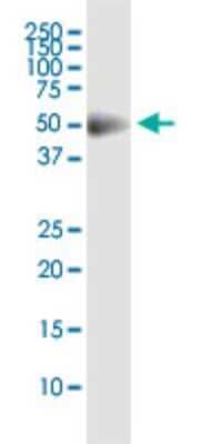 Western Blot: CDS2 Antibody (2B9) [H00008760-M01]