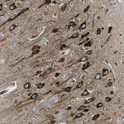 Immunohistochemistry-Paraffin: CDS2 Antibody [NBP1-86435]