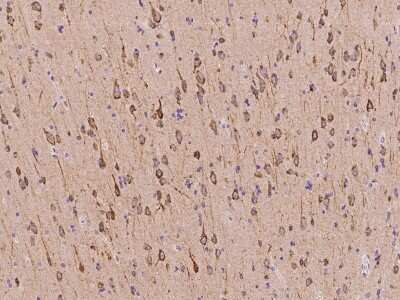 Immunohistochemistry-Paraffin: CDS2 Antibody [NBP2-97196]