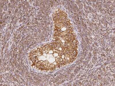 Immunohistochemistry-Paraffin: CDS2 Antibody [NBP2-97196]