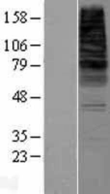 Western Blot: CDS2 Overexpression Lysate [NBP2-07950]