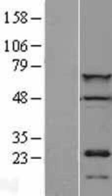 Western Blot: CDT1 Overexpression Lysate [NBL1-09063]